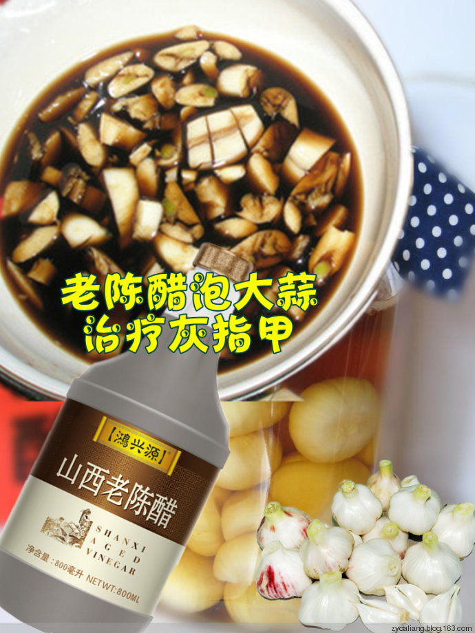 治愈灰指甲，幾乎是百分之一百 - 瀛子 - 瀛の小箋