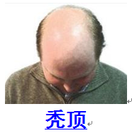 健康百科 - 財(cái)富玫瑰 - 財(cái)富玫瑰（陽光月月）
