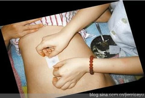 2.60元的藥外敷神闕，治好了女兒的鼻炎 - 瀛子 - 瀛の小箋